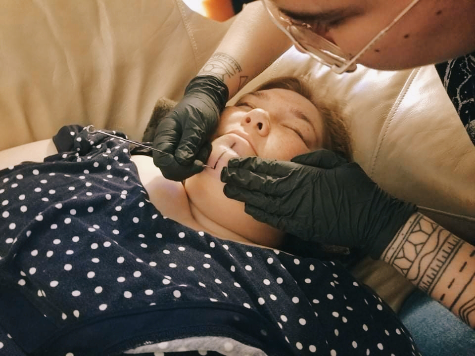 Traditional chin tattoo (tunniit) done in Iqaluktuuttiaq, 2021